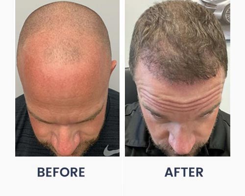 Before and After Medical Spa Gallery by Regency Medical Spa in Barrington, IL Before and After Medical Spa Gallery by Regency Medical Spa in Barrington, IL