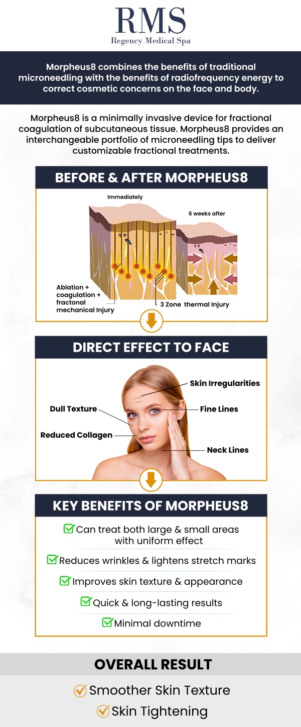Morpheus8 is a cutting-edge treatment that combines microneedling with radiofrequency energy to rejuvenate the skin, promoting collagen production and tightening the skin. At Regency Medical Spa and Hair Restoration Clinic, our professional team customizes each treatment to target specific concerns, delivering optimal results with minimal downtime. For more information, contact us today or book an appointment online. We are conveniently located at 300 Fox Glen Court Barrington, IL 60010. Morpheus8 is a cutting-edge treatment that combines microneedling with radiofrequency energy to rejuvenate the skin, promoting collagen production and tightening the skin. At Regency Medical Spa and Hair Restoration Clinic, our professional team customizes each treatment to target specific concerns, delivering optimal results with minimal downtime. For more information, contact us today or book an appointment online. We are conveniently located at 300 Fox Glen Court Barrington, IL 60010.