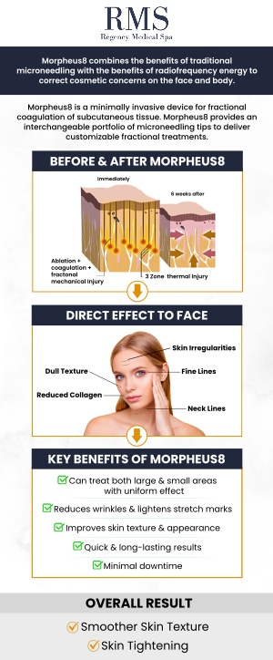 Morpheus8 is a cutting-edge treatment that combines microneedling with radiofrequency energy to rejuvenate the skin, promoting collagen production and tightening the skin. At Regency Medical Spa and Hair Restoration Clinic, our professional team customizes each treatment to target specific concerns, delivering optimal results with minimal downtime. For more information, contact us today or book an appointment online. We are conveniently located at 300 Fox Glen Court Barrington, IL 60010. Morpheus8 is a cutting-edge treatment that combines microneedling with radiofrequency energy to rejuvenate the skin, promoting collagen production and tightening the skin. At Regency Medical Spa and Hair Restoration Clinic, our professional team customizes each treatment to target specific concerns, delivering optimal results with minimal downtime. For more information, contact us today or book an appointment online. We are conveniently located at 300 Fox Glen Court Barrington, IL 60010.