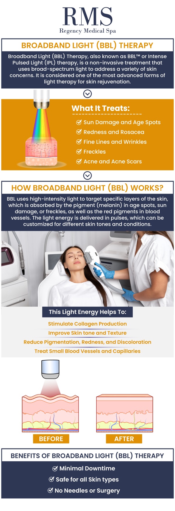 Broadband Light (BBL) Laser Treatment is an advanced therapy designed to improve skin tone and texture. Using cutting-edge technology, BBL targets skin imperfections such as age spots, acne, and sun damage, leaving your skin looking youthful and refreshed. At Regency Medical Spa and Hair Restoration Clinic, our professional team is committed to delivering personalized care for your skincare needs. For more information, contact us today or book an appointment online. We are conveniently located at 300 Fox Glen Court Barrington, IL 60010.
