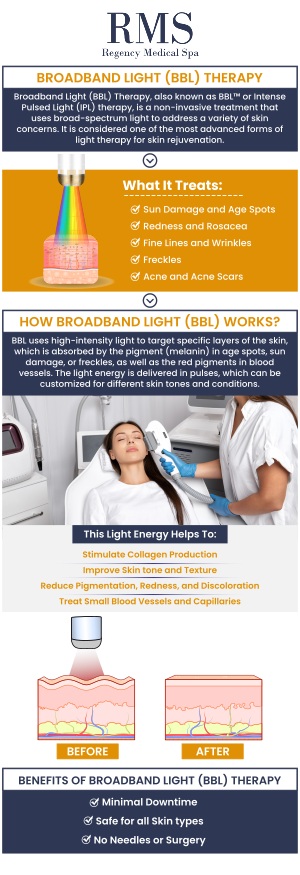 Broadband Light (BBL) Laser Treatment is an advanced therapy designed to improve skin tone and texture. Using cutting-edge technology, BBL targets skin imperfections such as age spots, acne, and sun damage, leaving your skin looking youthful and refreshed. At Regency Medical Spa and Hair Restoration Clinic, our professional team is committed to delivering personalized care for your skincare needs. For more information, contact us today or book an appointment online. We are conveniently located at 300 Fox Glen Court Barrington, IL 60010.