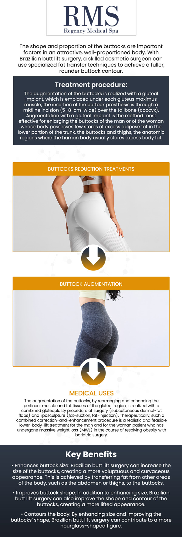 At Regency Medical Spa and Hair Restoration Clinic, our professional team offers the Sculptra Brazilian Butt Lift (BBL) as a safe, non-surgical option for enhancing curves and improving volume. Unlike traditional procedures, Sculptra works by stimulating natural collagen production for a fuller, lifted, and more contoured appearance. With minimal downtime and long-lasting results, this treatment is ideal for those seeking a natural-looking enhancement without the risks of surgery. For more information, contact us today or book an appointment online. We are conveniently located at 300 Fox Glen Court Barrington, IL 60010. At Regency Medical Spa and Hair Restoration Clinic, our professional team offers the Sculptra Brazilian Butt Lift (BBL) as a safe, non-surgical option for enhancing curves and improving volume. Unlike traditional procedures, Sculptra works by stimulating natural collagen production for a fuller, lifted, and more contoured appearance. With minimal downtime and long-lasting results, this treatment is ideal for those seeking a natural-looking enhancement without the risks of surgery. For more information, contact us today or book an appointment online. We are conveniently located at 300 Fox Glen Court Barrington, IL 60010.